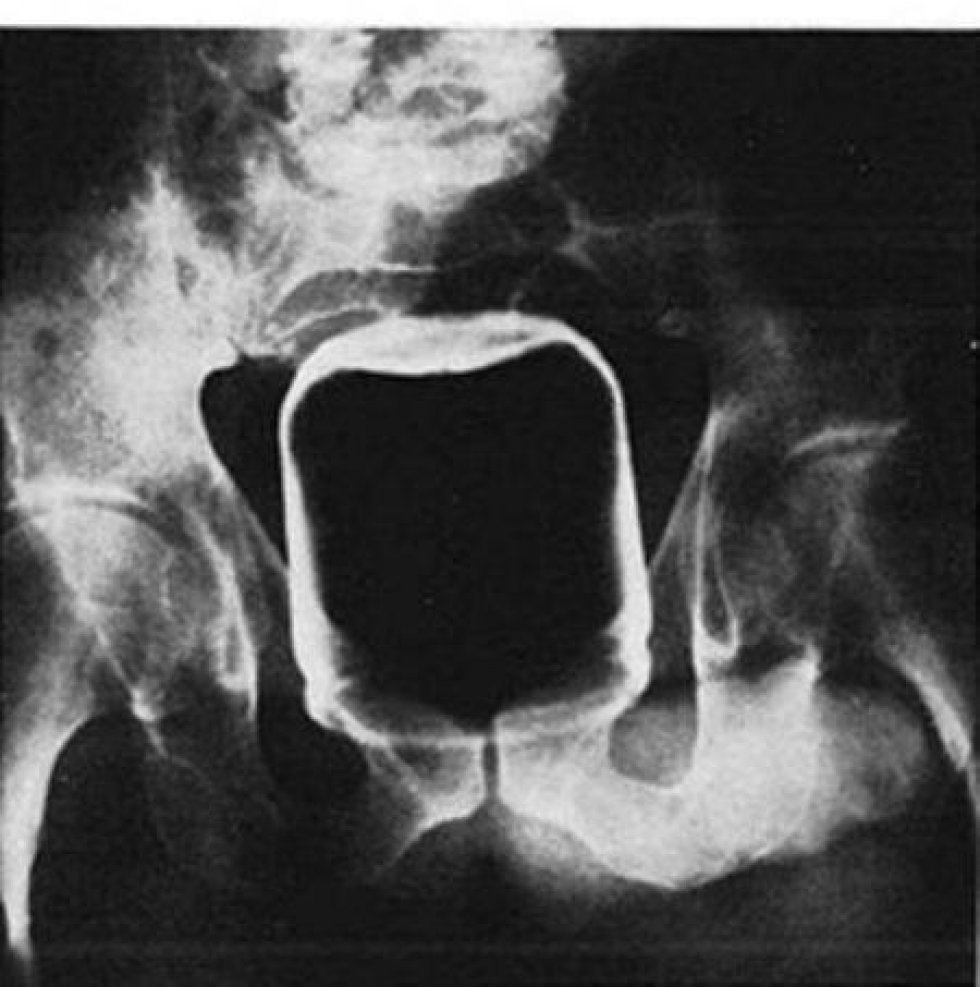 Рентген необычные предметы внутри