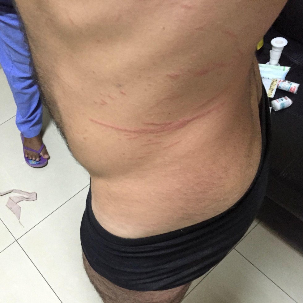 Kærestepar kidnappet af kannibaler: "De flåede tøjet af os og slog os til blods med macheter"