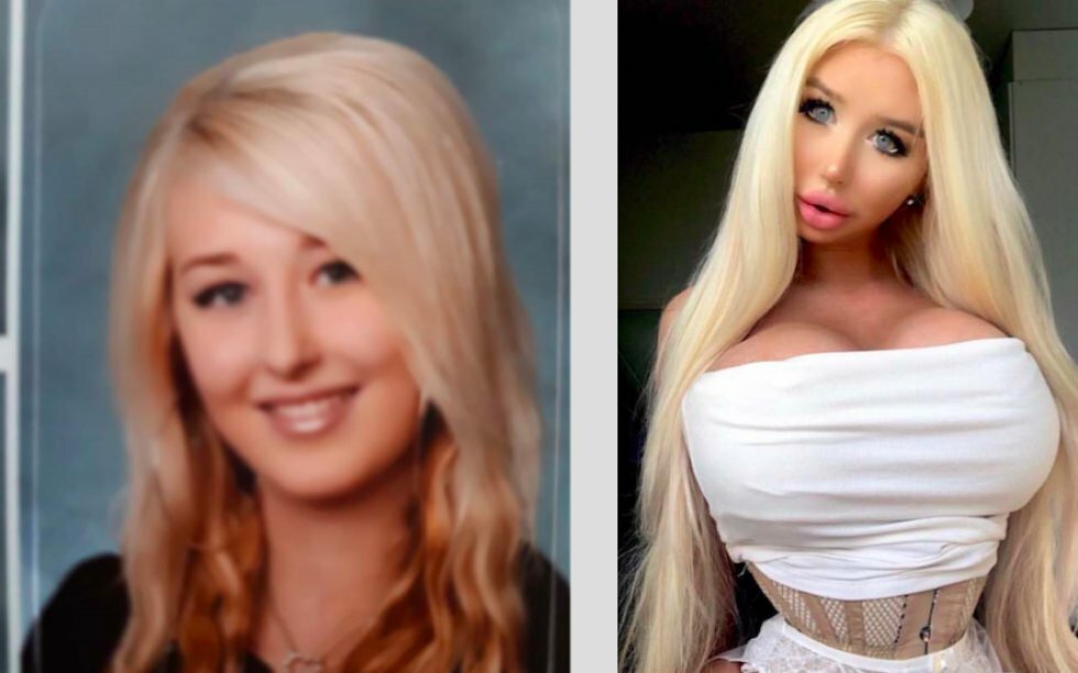 22-årig kvinde har brugt 300k på at ligne en Barbiedukke