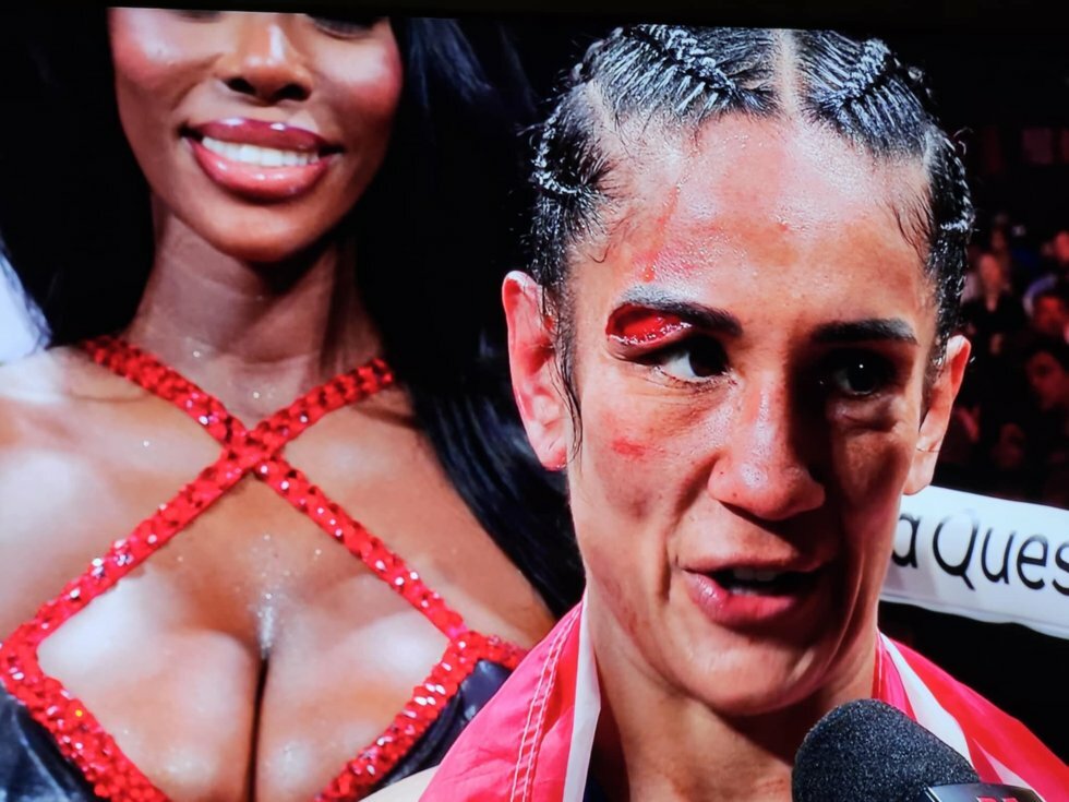 Serrano fortæller at hendes heftige flænge skyldes Taylors hovedstød efter kampen - Foto: Netflix - Drama i Dallas: Katie Taylor forsvarer titlen mod Amanda Serrano i kontroversiel rematch