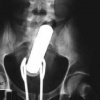 Disse bizarre røntgenfotos beviser, hvor dumme folk kan blive, når de er liderlige