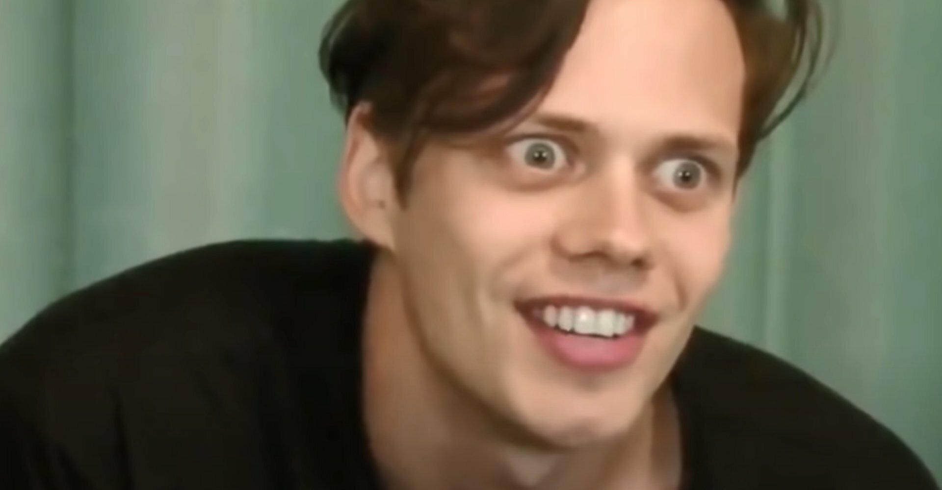 Bill skarsgard lazy eye