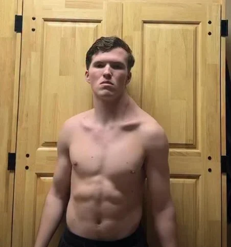 onearmman