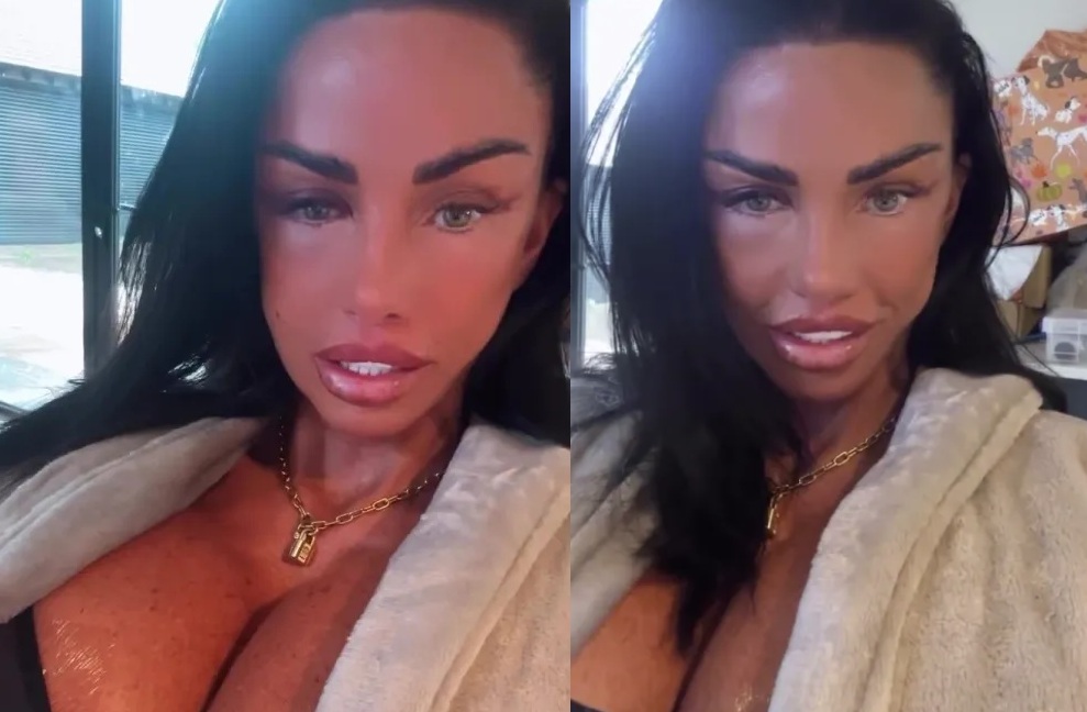 Katie Price viser blå øje og hævede babser efter ny operation